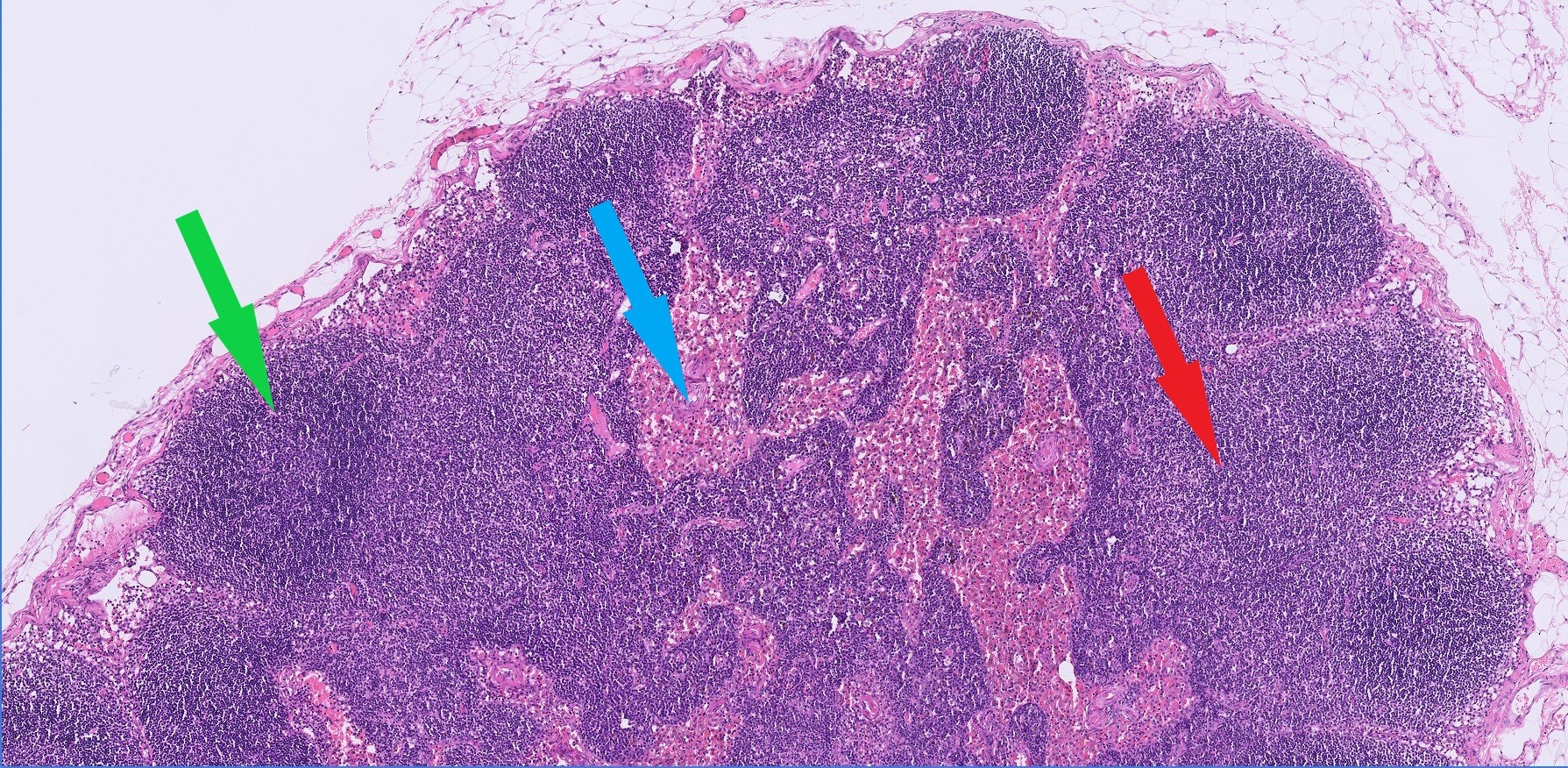 Lymph node biopsy – excise, don’t incise - Awanui Veterinary